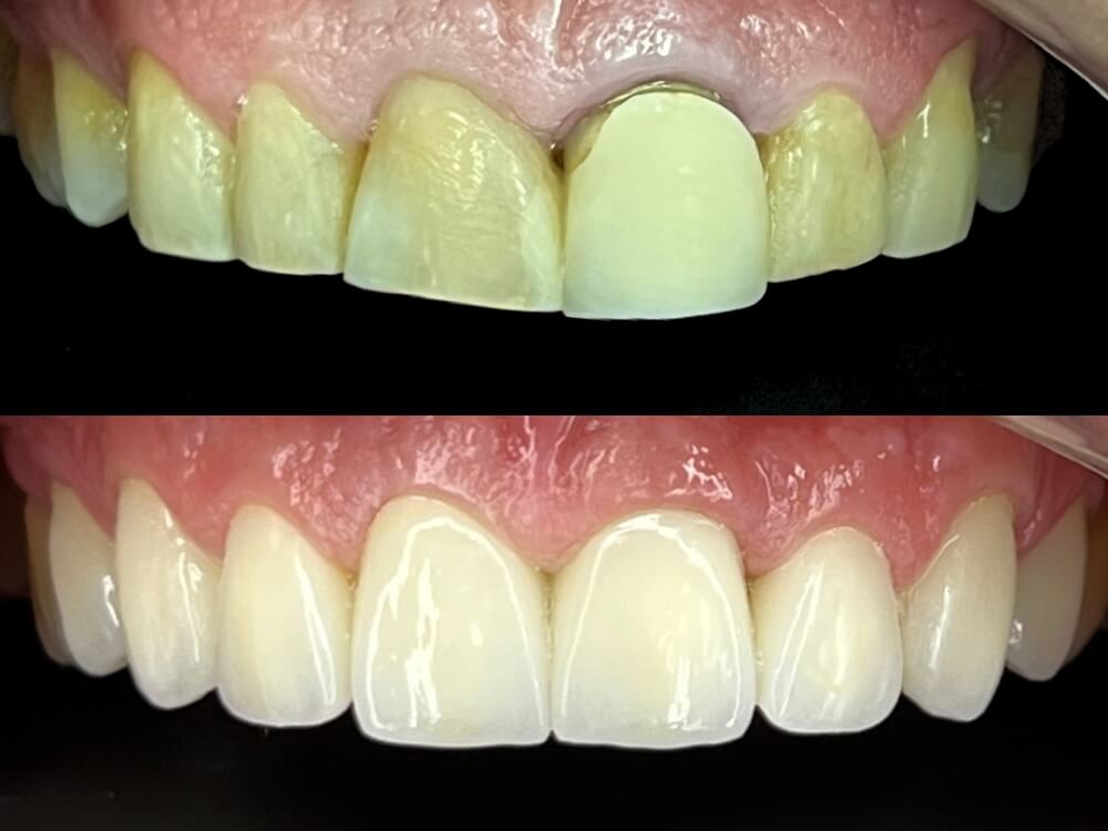 Dr. Humberto Berwanger - Cirurgião-dentista 2 05 4