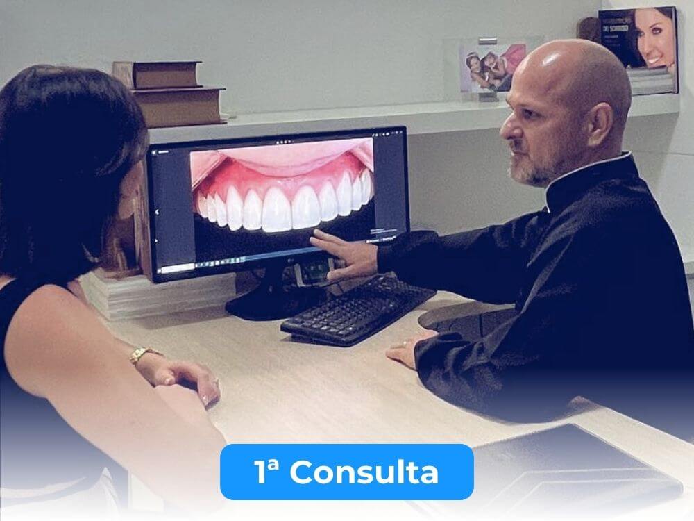 Facetas e Lentes de Contato Dental - Dr. Humberto Berwanger - Cirurgião-dentista 4 49