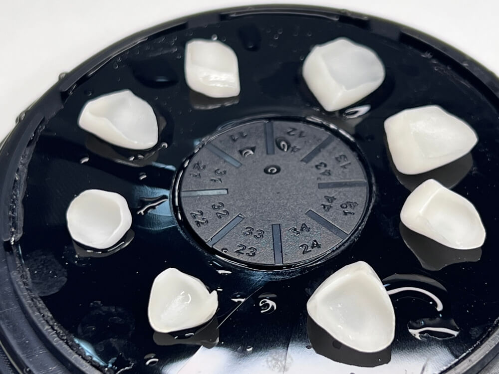 Facetas e Lentes de Contato Dental - Dr. Humberto Berwanger - Cirurgião-dentista 22 53 1