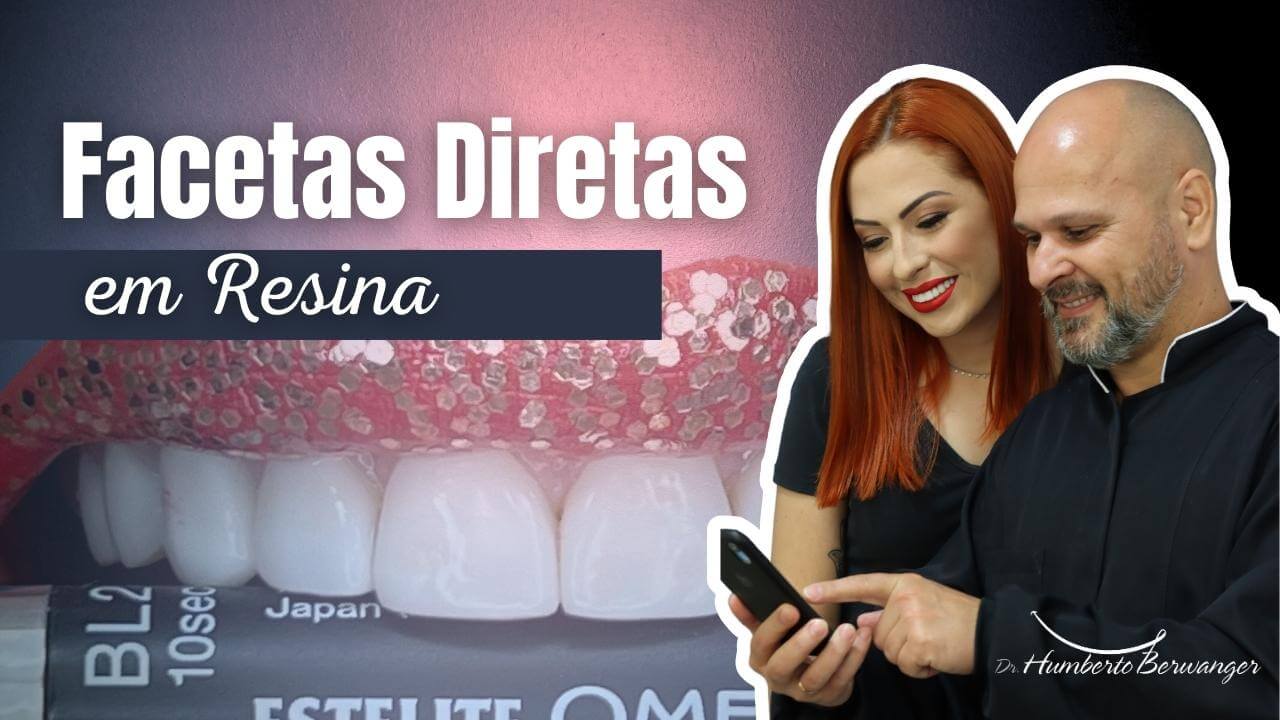 Thumbnail 02 Facetas Diretas 1