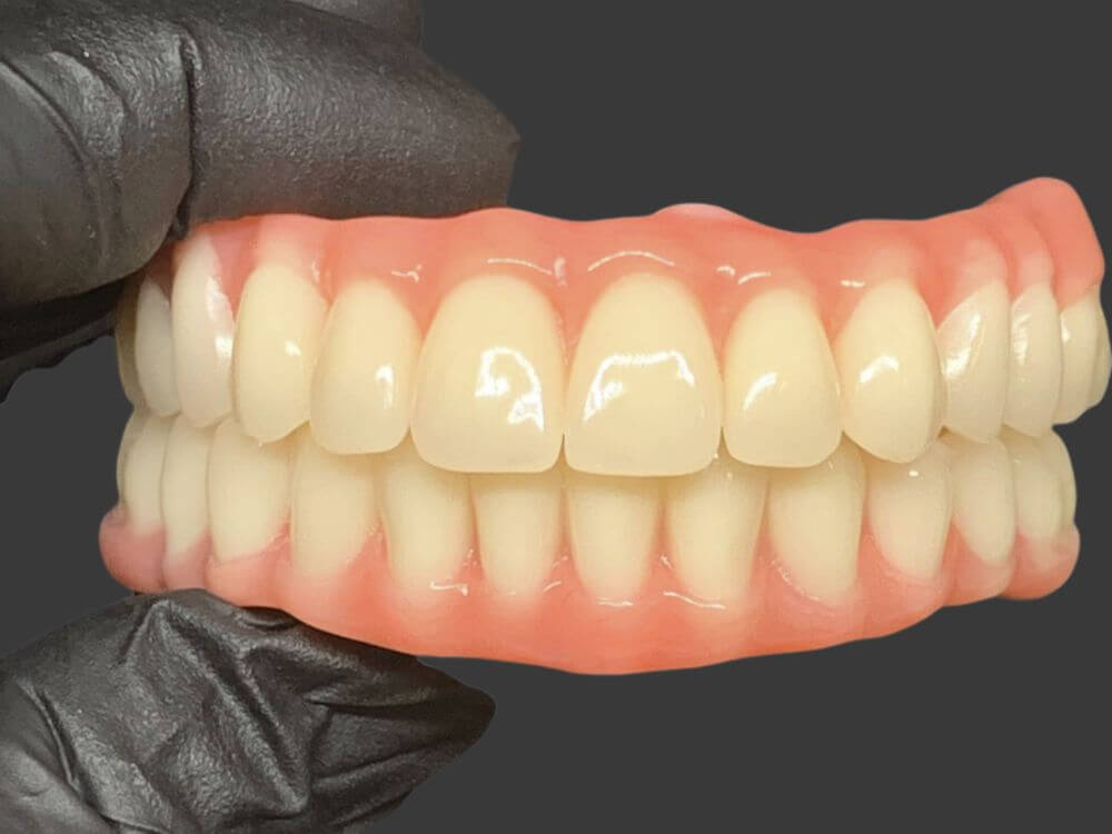 Implantes Dentários - Dr. Humberto Berwanger - Cirurgião-dentista 16 54