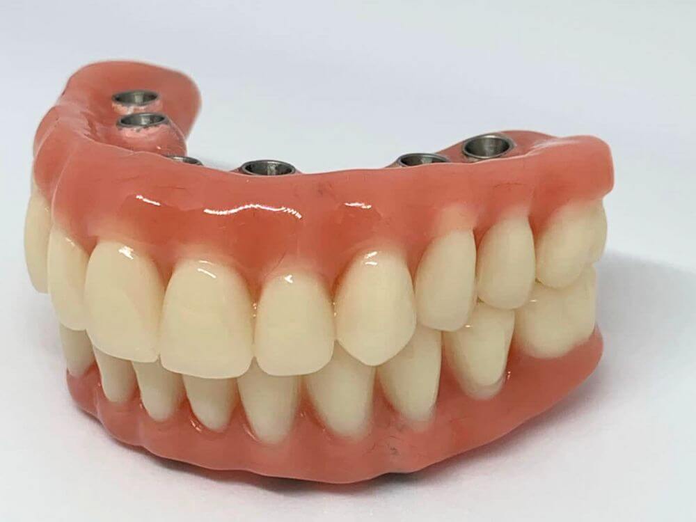 Implantes Dentários - Dr. Humberto Berwanger - Cirurgião-dentista 12 64