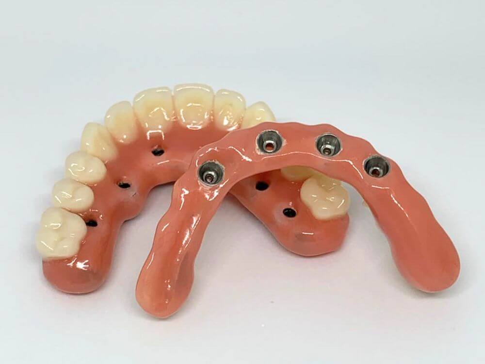 Implantes Dentários - Dr. Humberto Berwanger - Cirurgião-dentista 9 65
