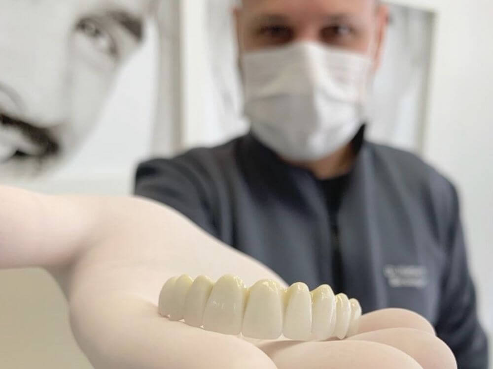 Implantes Dentários - Dr. Humberto Berwanger - Cirurgião-dentista 1 70